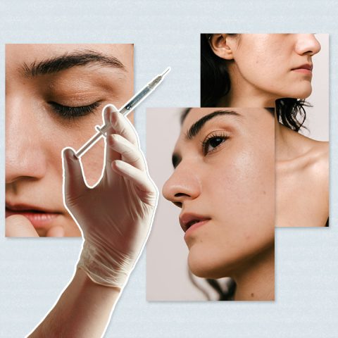 prp therapy