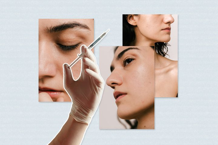 prp therapy
