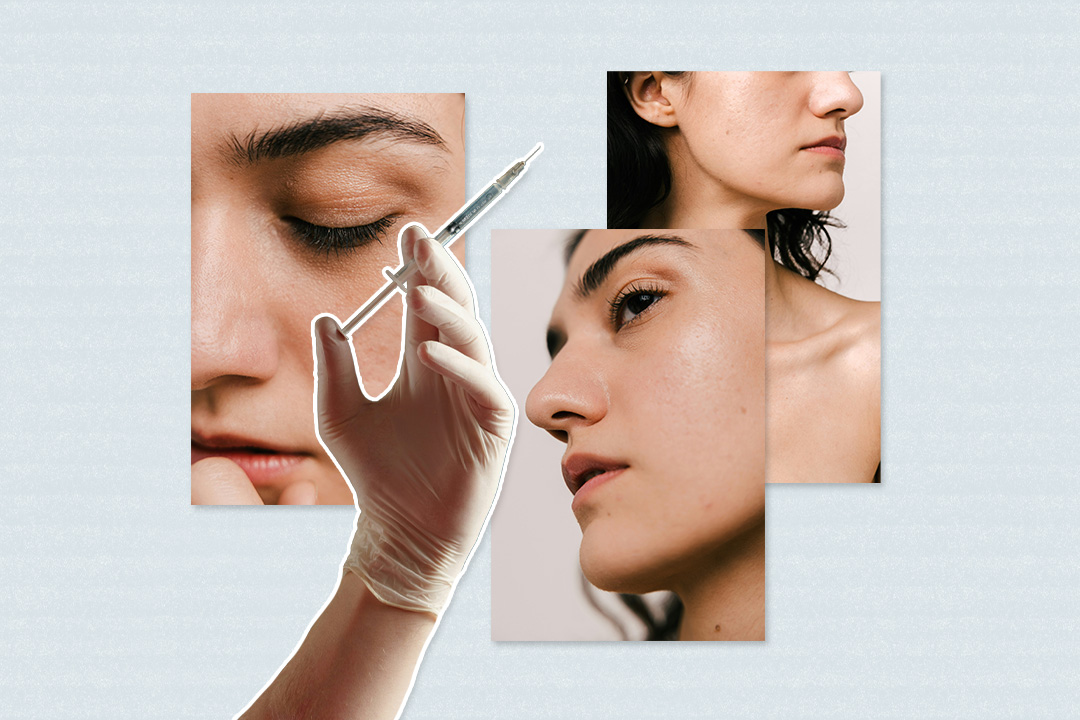 I Tried PRP for My Tired-Looking Under-Eyes—Here’s How It Went
