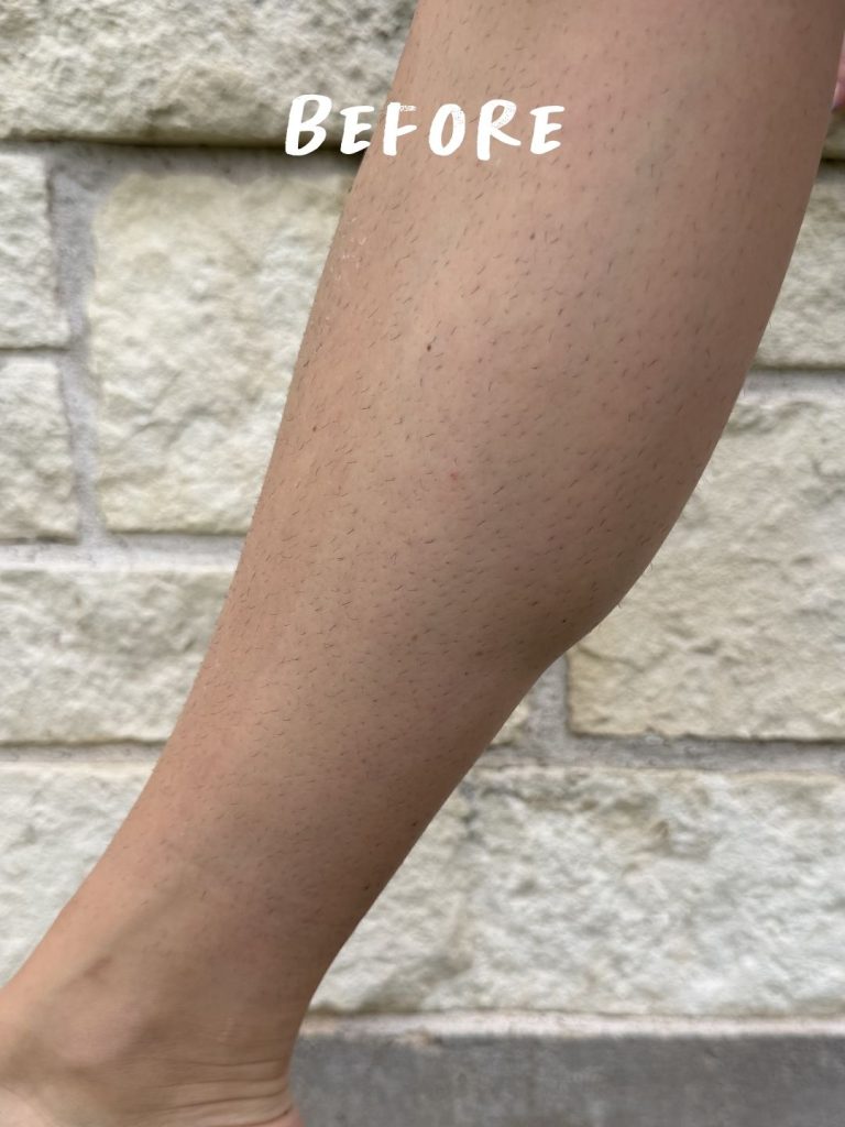 Veet 2-Minute Cream before and after