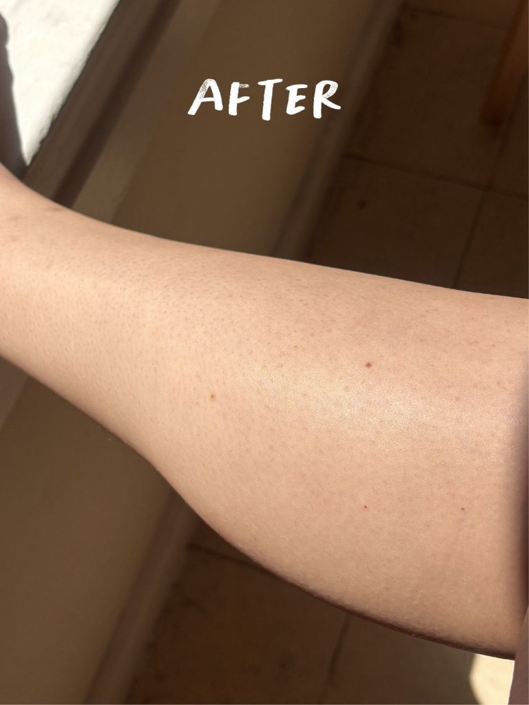 Veet 2-Minute Cream before and after