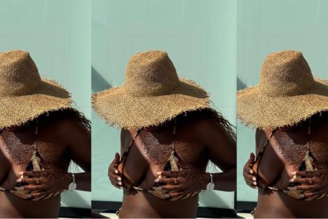 how to prevent sun damage